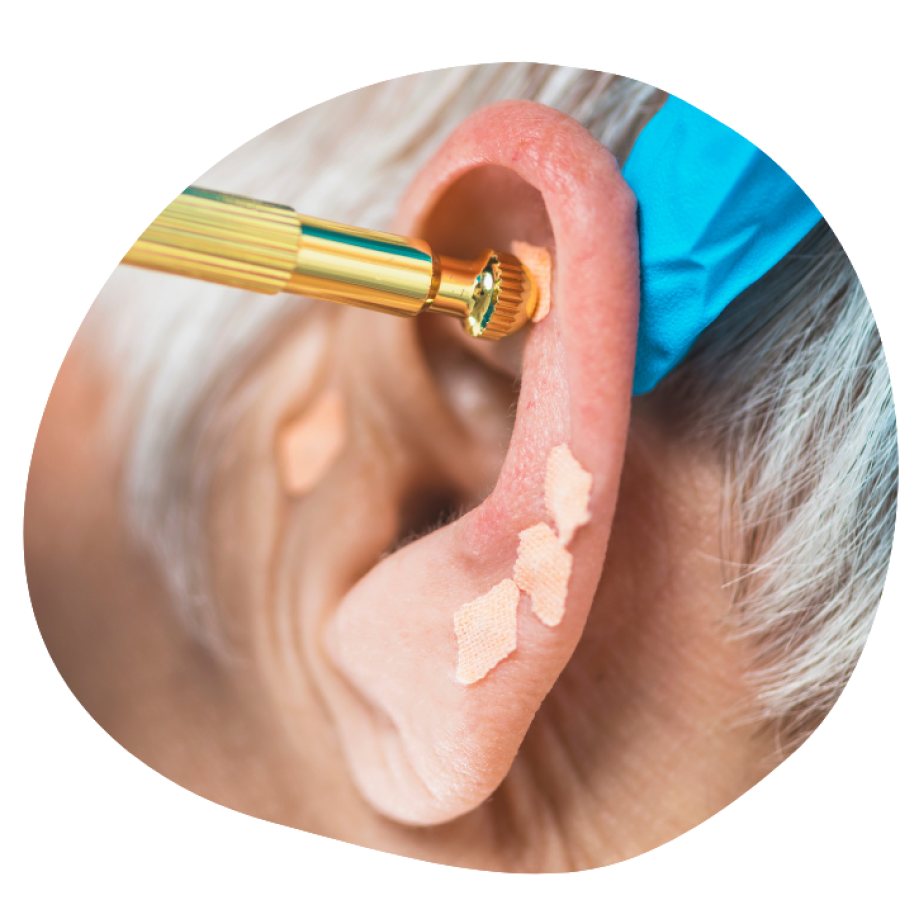 Post Instagram Auriculoterapia Marrom e Bege